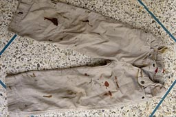 Boys pants, stained of chocolate and blood, not from a crime scene.
