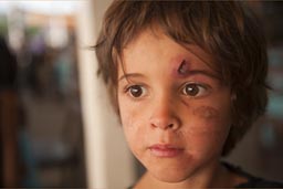 Warrior face, Daniel. Well he hit his head after he suffered the initial bout of intoxication and had a completely swollen face, or allergic reaction against dog or parrot, shit, or just too much sugar. In hospital in Huaraz they both, yes David suffered same thing, got vaccination and it helped, thanks to Peru hospital doctors.